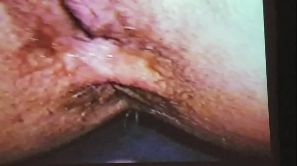 Tươi Close up anal ống của tôi